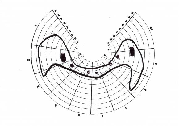 anamorphose cylindrique 